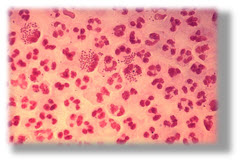 PHIL_4085_public_domain_from_cdc_enhanced.jpg - 16.89 kB